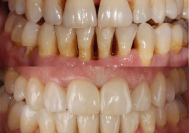 periodoncia