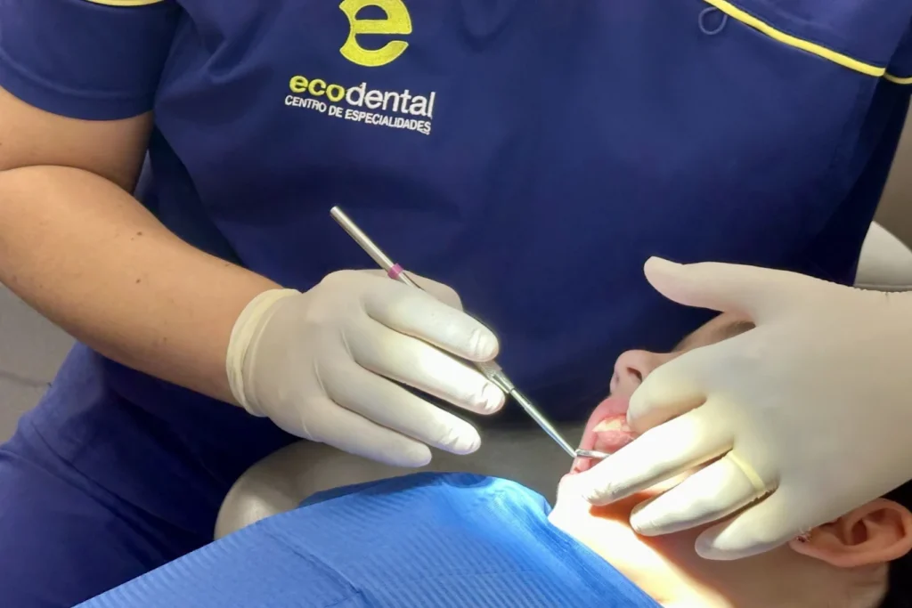 beneficios de la limpieza dental