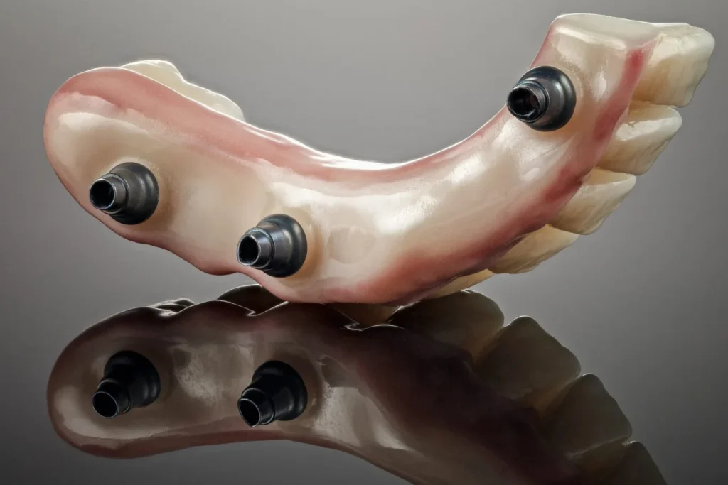 beneficios de las prótesis dentales