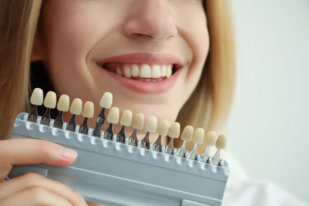 carillas dentales en tudela