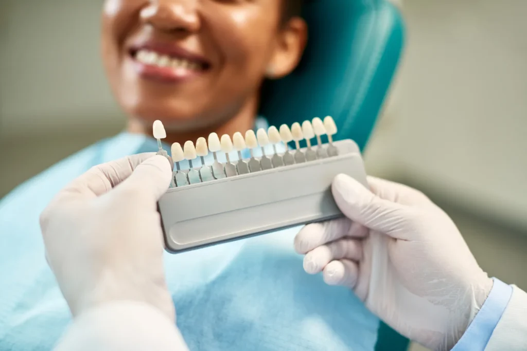 tratamientos de estética dental