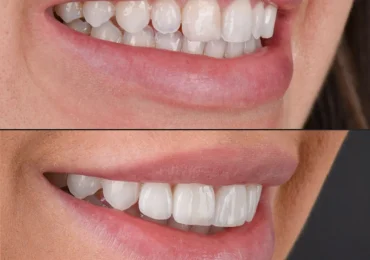 estética dental